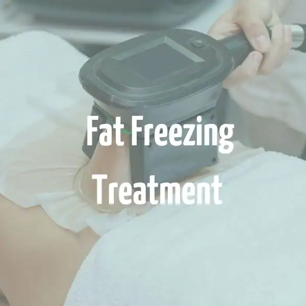 fat freezing treatment Bishop's Stortford