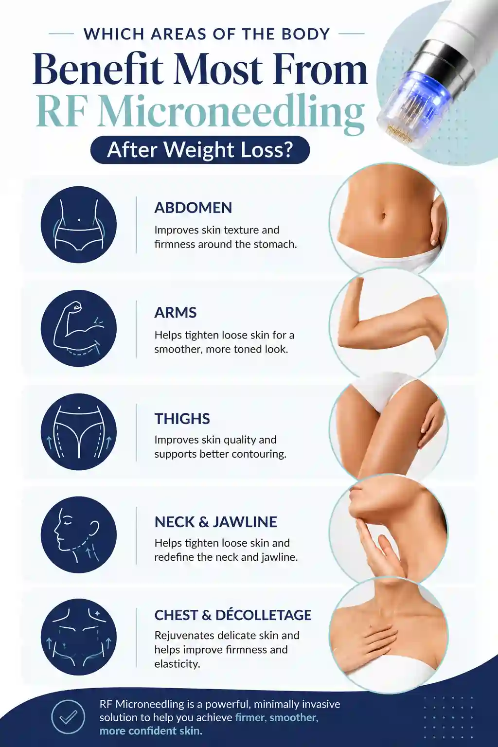 Which Areas of the Body Benefit Most From RF Microneedling After Weight Loss Bishop's Stortford